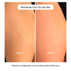 Cos-IQ Stretch Marks Removal Roll-On Serum with Striover