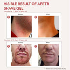 Ivory Natural After Shave Gel For Gentle Post-Shave, Reduced Facial Worries