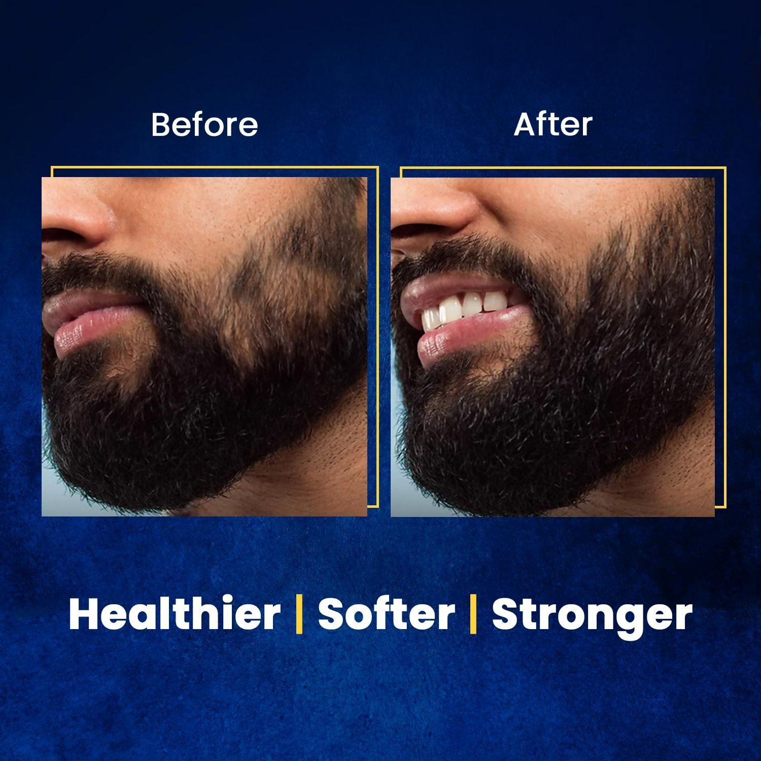 The Beard Story Beard Oil For Men