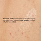 The Ordinary Salicylic Acid 0.5% Body Serum