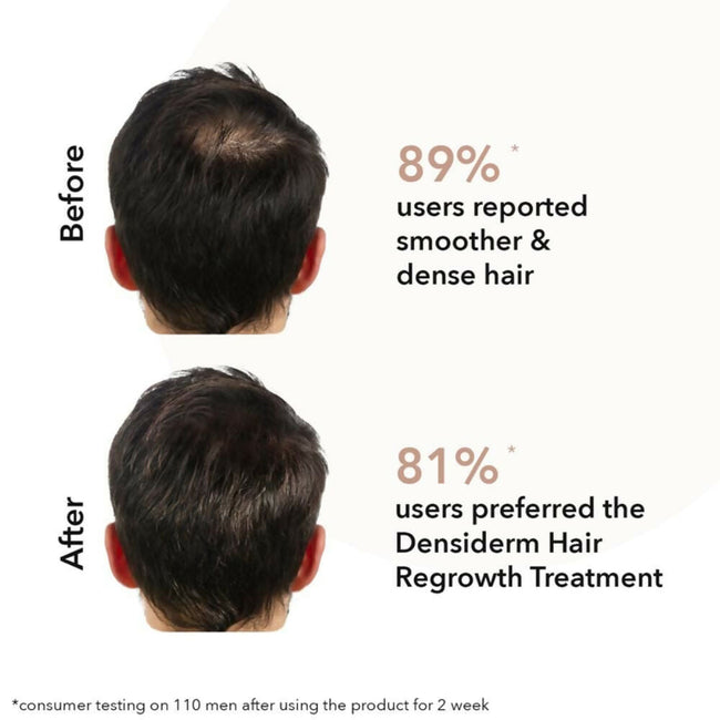 Professional O3+ Men Densiderm Anti Hair Loss Shampoo For Dense Hair & Regrowth Main Image