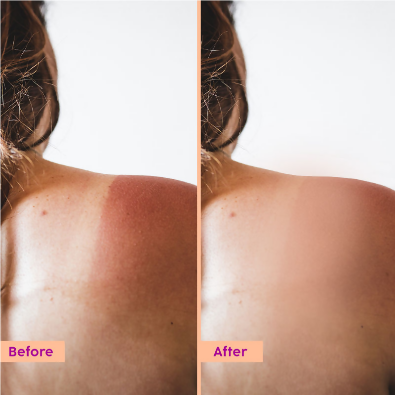 PLIX The Plant Fix Peaches & Lemon Detan Body Lotion with SPF 30