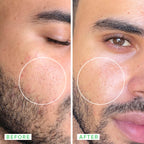 Farmacy Beauty Deep Sweep 2% BHA Pore Cleaning Toner With Salicylic Acid & Moringa Water