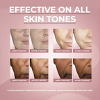 Eucerin Anti-Pigment Dark Circle Eye Corrector Serum