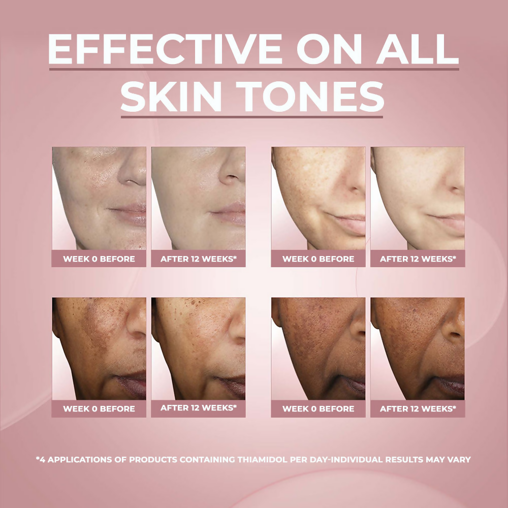 Eucerin Anti-Pigment Dark Circle Eye Corrector Serum