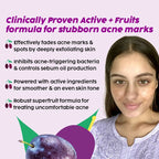 PLIX The Plant Fix 10% Niacinamide Face Serum For Acne Marks, Blemishes, Oil Control