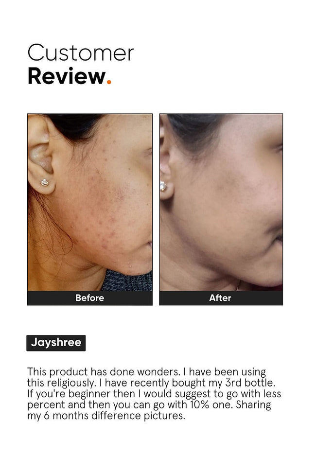 Minimalist 10% Niacinamide Face Serum Main Image