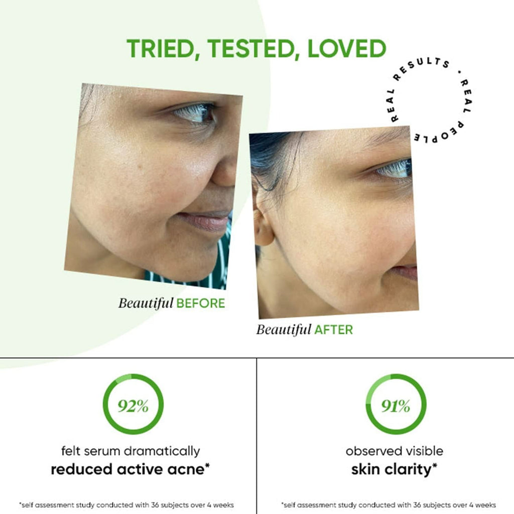 Dot & Key 2% Salicylic Cica Anti Acne Face Serum For Irritation & Unclogs Pores