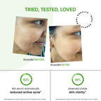 Dot & Key 2% Salicylic Cica Anti Acne Face Serum For Irritation & Unclogs Pores