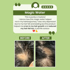 Alps Goodness Rosemary Water for Hair Regrowth