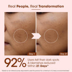 TAC Kumkumadi Gold Glow Face Oil | 100% Pure Ayurvedic Formula | For Glowing & Youthful Skin