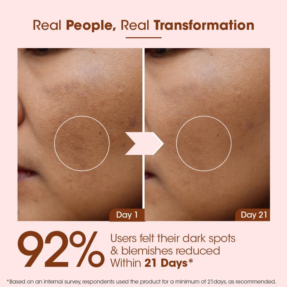 TAC Kumkumadi Gold Glow Face Oil | 100% Pure Ayurvedic Formula | For Glowing & Youthful Skin