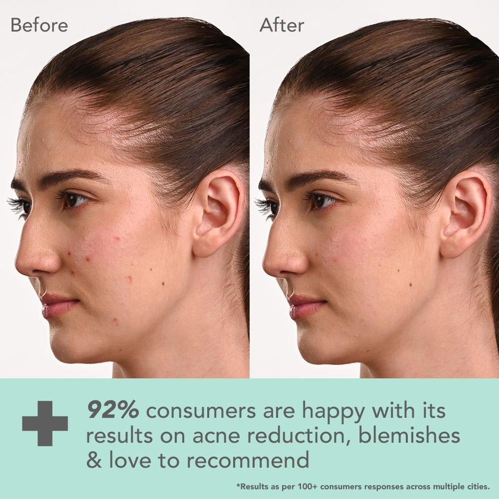 Lotus DermaBotanics Kojic Acid + Multi Berry Blemish-Free Face Wash, pH5.5, For Sensitive Skin