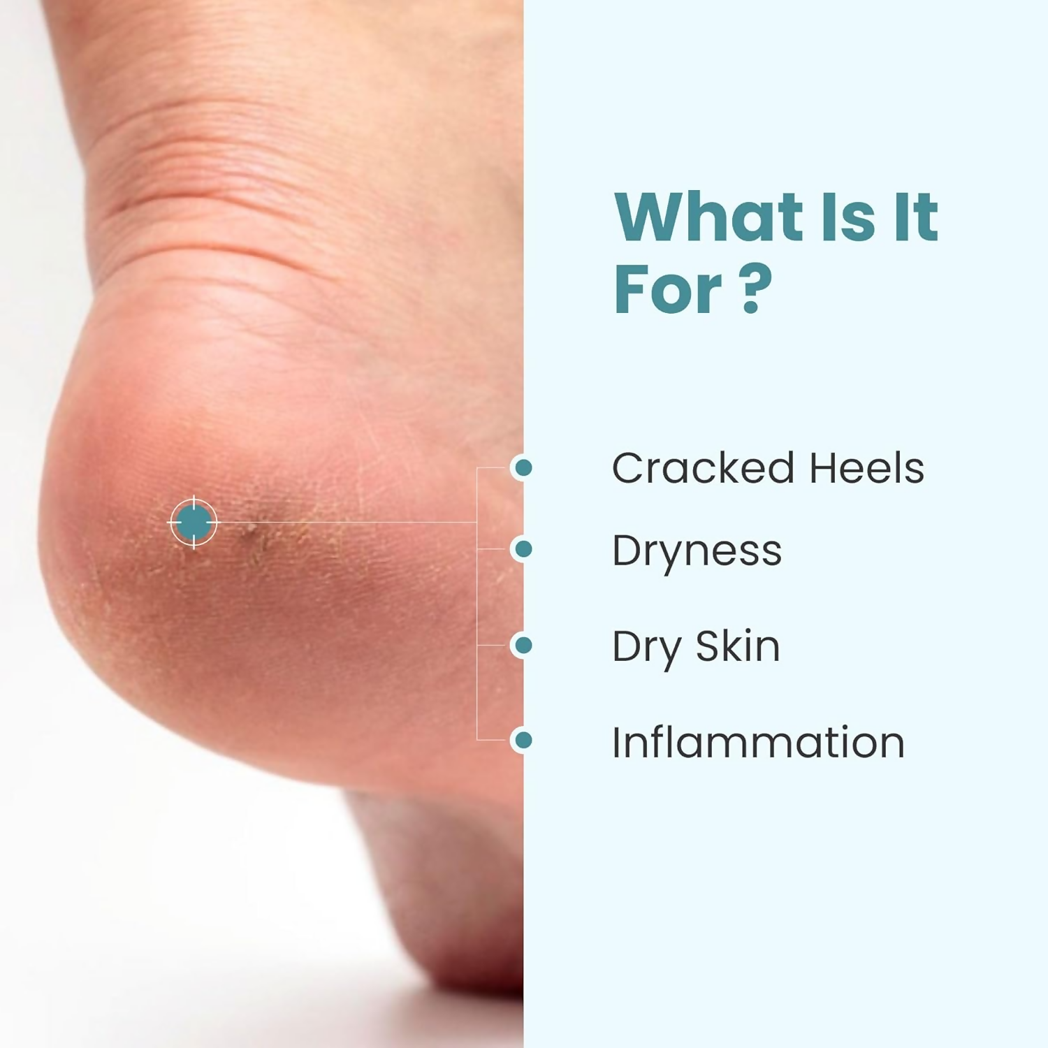 Uniqaya Foot Care Cream Repairs Cracked Heel