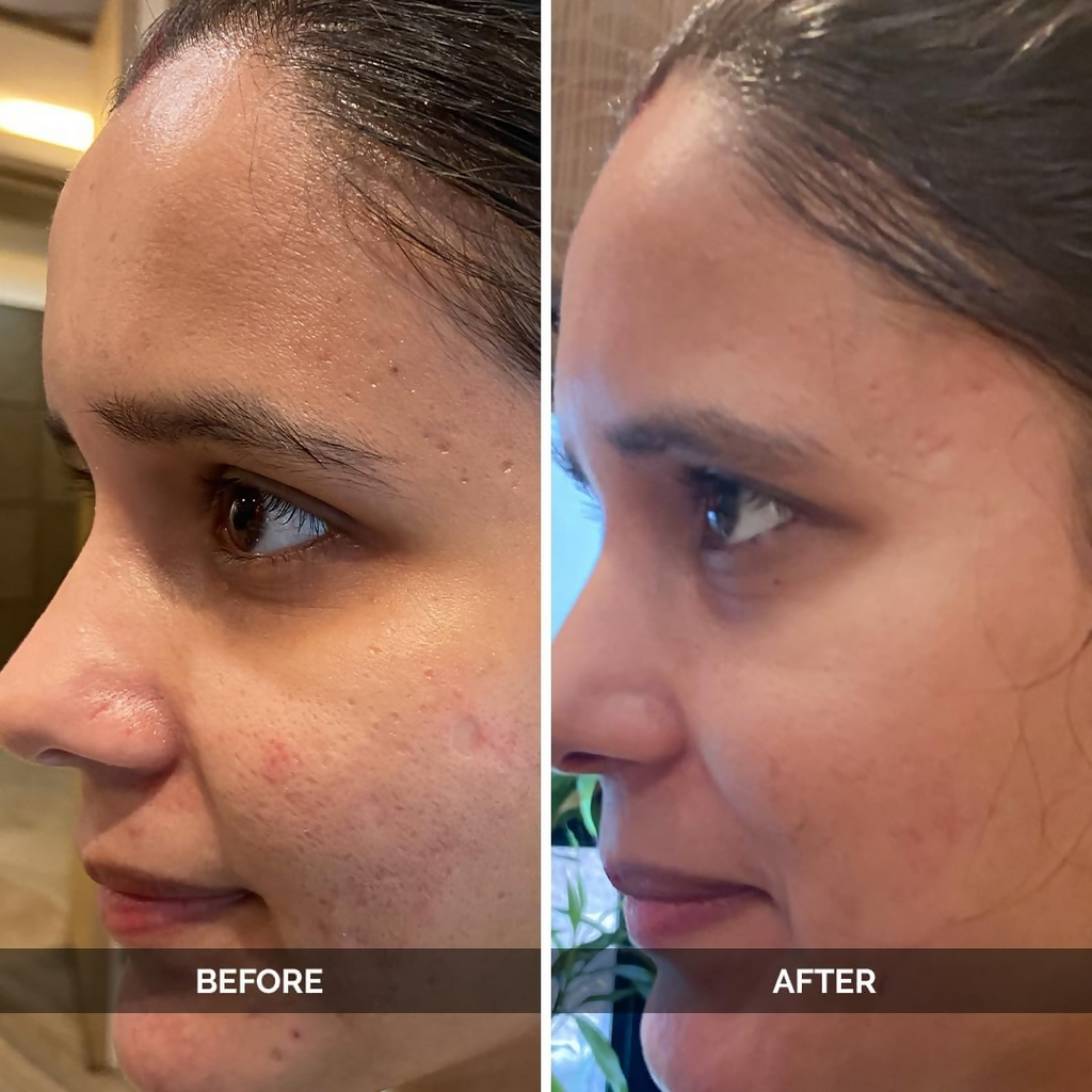 LuxaDerme Pore Perfecting Face Serum