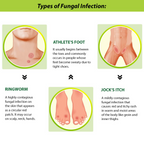 Tetmosol Dusting Powder
