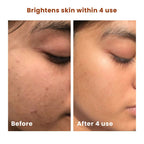 The Skin Story Salicylic Acid Brightening Face Scrub