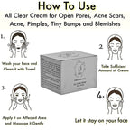 Saroj Organics All Clear Cream For Acne, Pimples