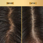 The Skin Story Anti-Dandruff Hair Scalp Serum