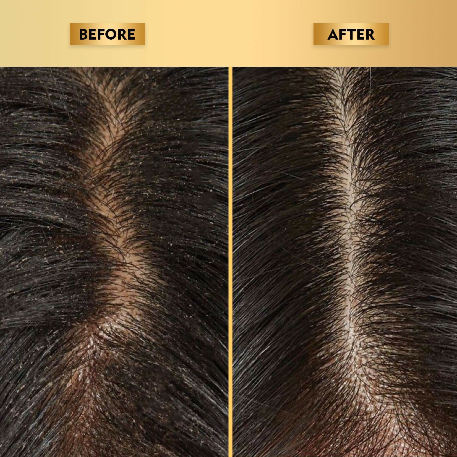 The Skin Story Anti-Dandruff Hair Scalp Serum