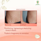 Adonis Strie Stretch Mark Cream