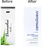 Dermadew Aloe Plus Moisturiser Lotion