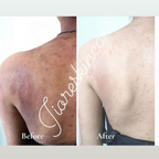 Pinkin Jiore skincare sinche Body Soap