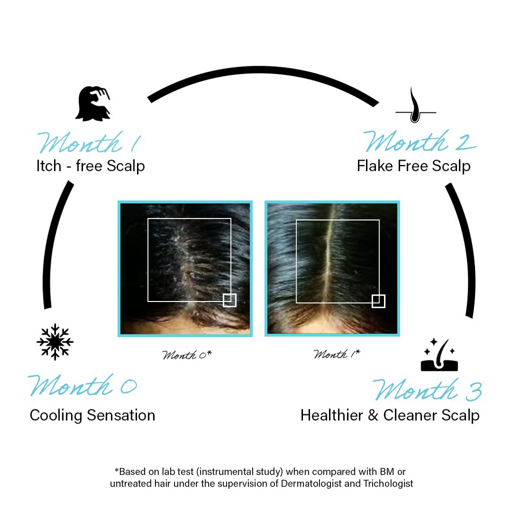 Rootcos Salicylic Acid Anti-Dandruff Serum