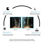 Rootcos Salicylic Acid Anti-Dandruff Serum