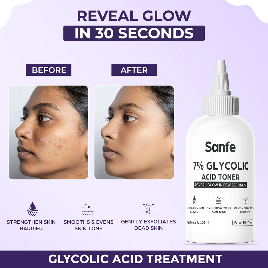 Sanfe 7% Glycolic Acid Ordinary Toner