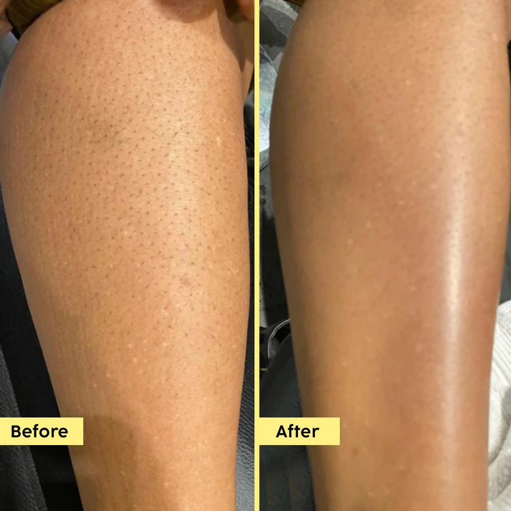 PLIX The Plant Fix Pineapple 5% Lactic Acid Body Wash Exfoliates Dry, Rough & Strawberry Skin