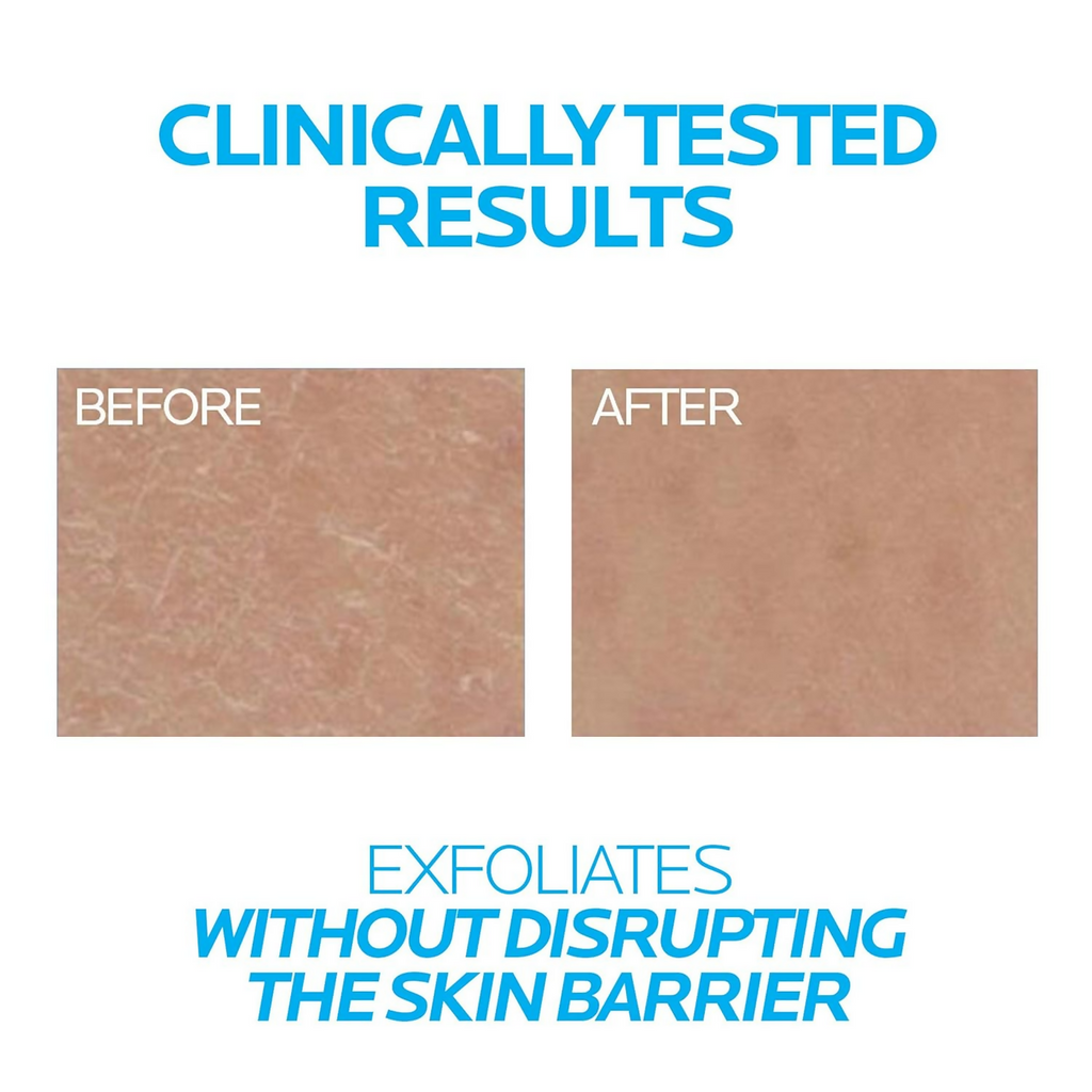 La Roche-Posay Lipikar Urea10% Roughness Smoothing Lotion