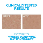 La Roche-Posay Lipikar Urea10% Roughness Smoothing Lotion