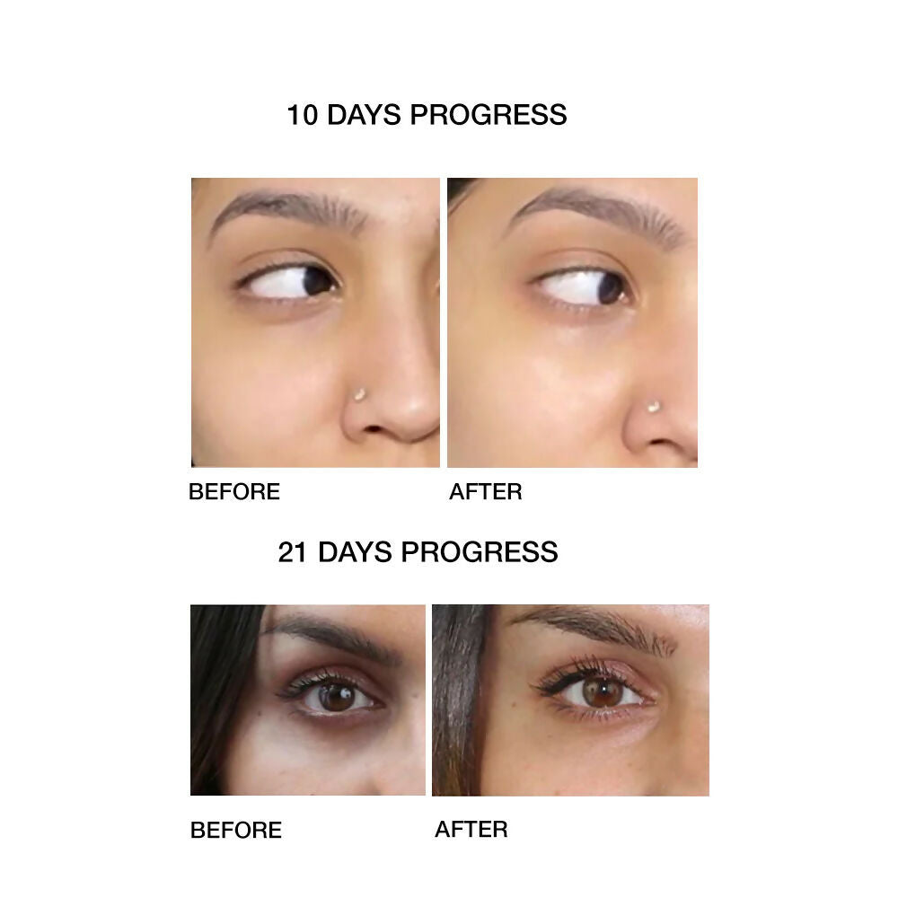 Skog Under Eye Repair Oil