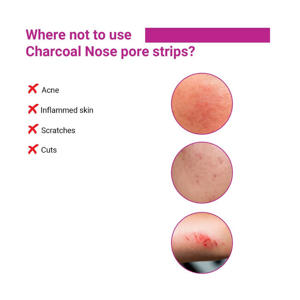 Sotrue Charcoal Nose Pore Deep Cleansing Strips
