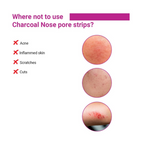Sotrue Charcoal Nose Pore Deep Cleansing Strips