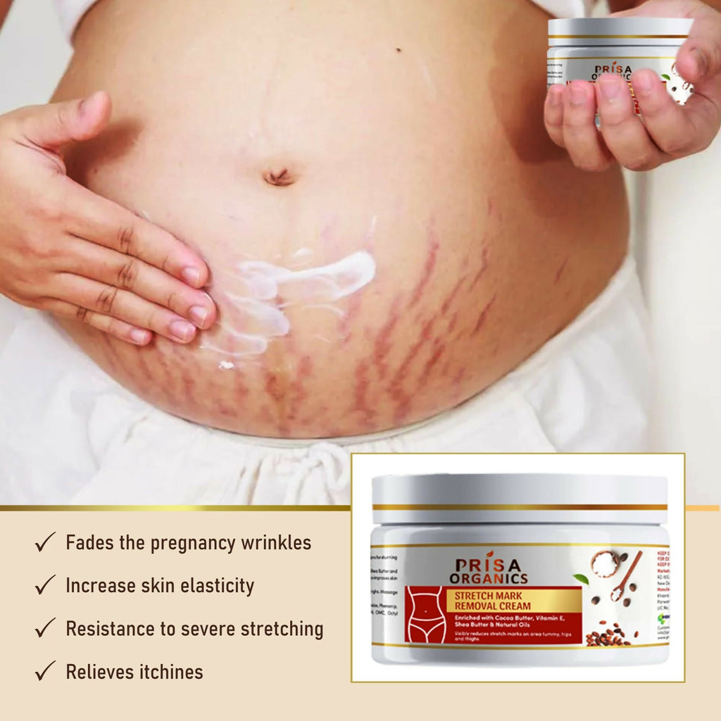 Prisa Organics Stretch Mark Removal Cream To Reduce Stretch Marks, Scars, Spots, Discolouration