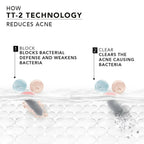 Novology Acne Spot Corrector Gel With 0.1% Thymol + Terpineol