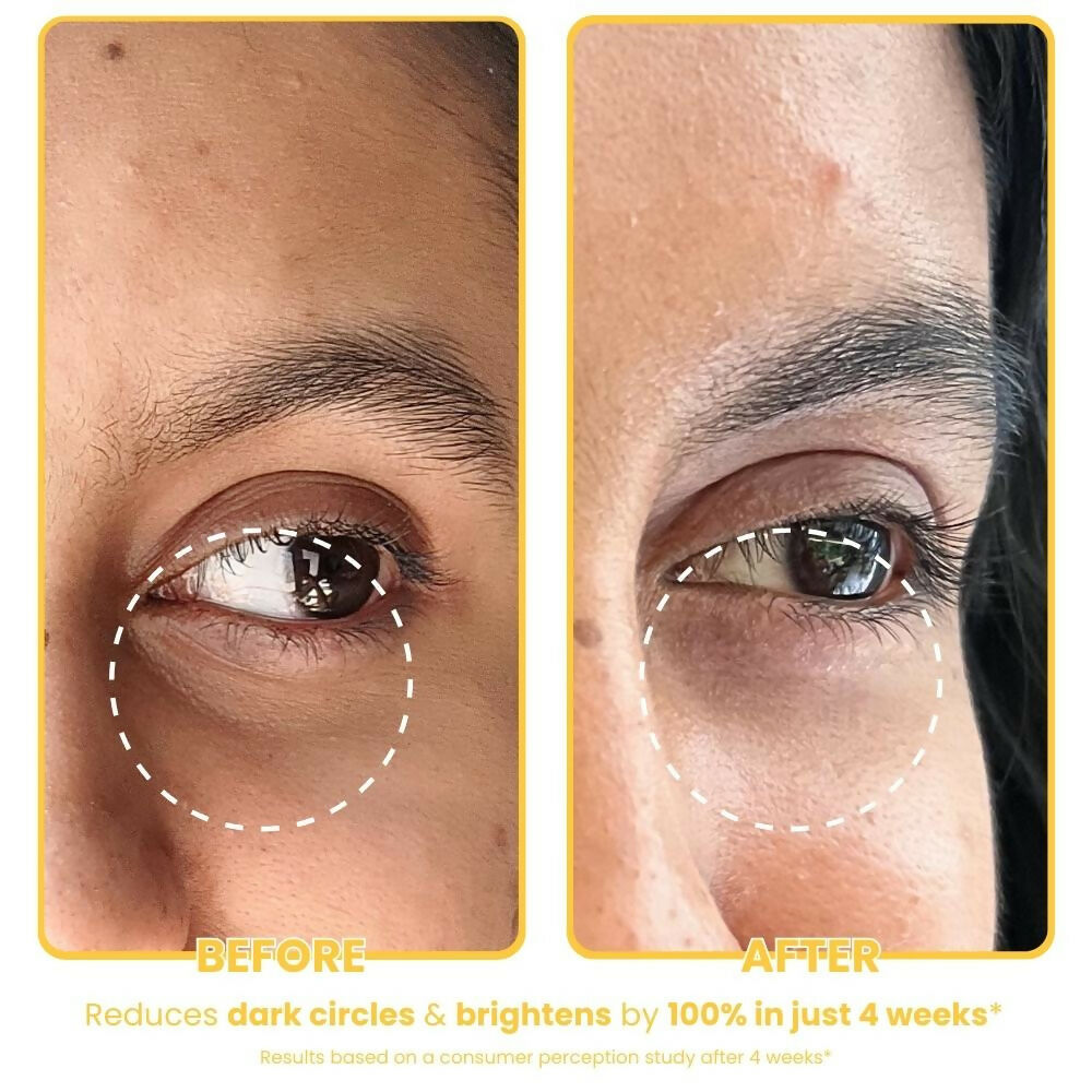 The Skin Diet Company Banana Brightening Under-Eye Cream - Dark Circles, Fine Lines with Niacinamide