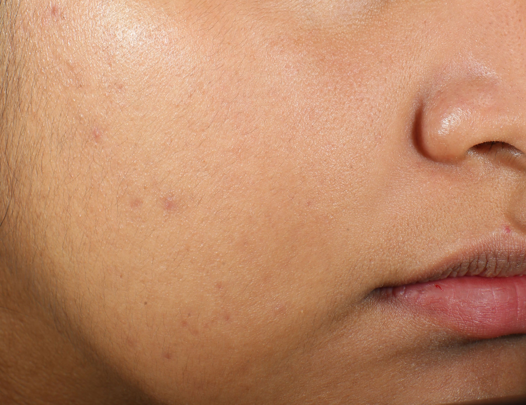 Murad Clarifying Water Gel