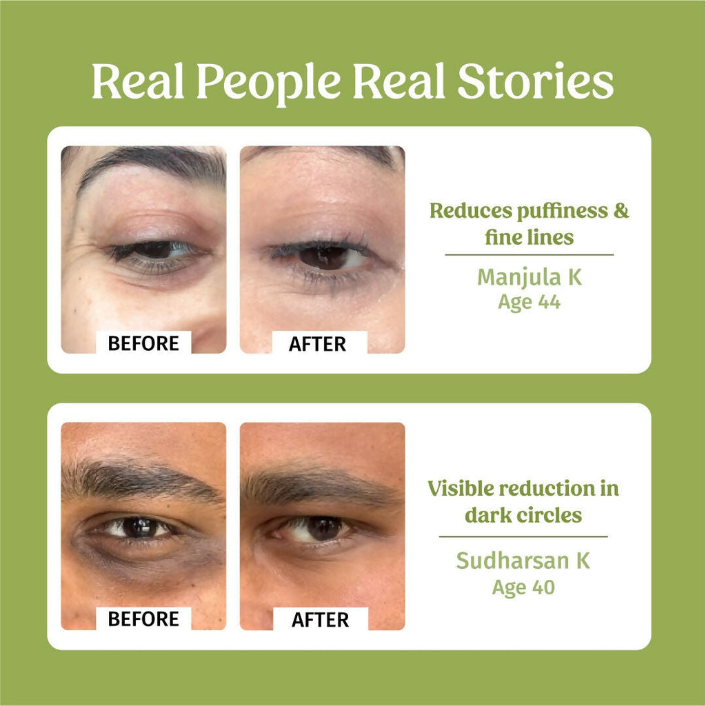 Vilvah Store Under Eye Cream (Dark Circle Control)