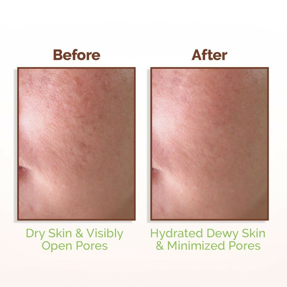 Mamaearth Rice Water Dewy Face Toner with 96% Pure Rice Water Extract & 4% Niacinamide for Glass Skin