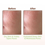 Mamaearth Rice Water Dewy Face Toner with 96% Pure Rice Water Extract & 4% Niacinamide for Glass Skin