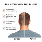 Beauty Secrets Saw Palmetto Hair Growth Serum