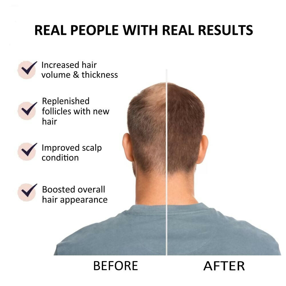 Beauty Secrets Saw Palmetto Hair Growth Serum