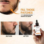 Nourish Mantra Advanced Beard Growth Oil Serum with Redensyl
