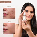 Dromen & Co Niacinamide Serum - Fights acne & blemishes Tighten Pores