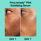 Dr.Jart+ Pore Remedy PHA Exfoliating Serum