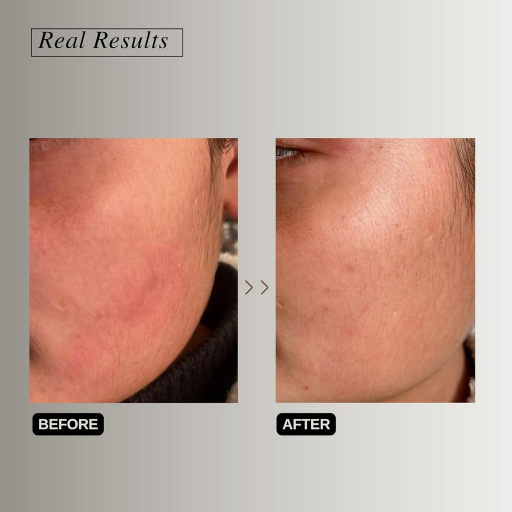 The Formularx Peptide Ceramide Moisturizer - Barrier Plus