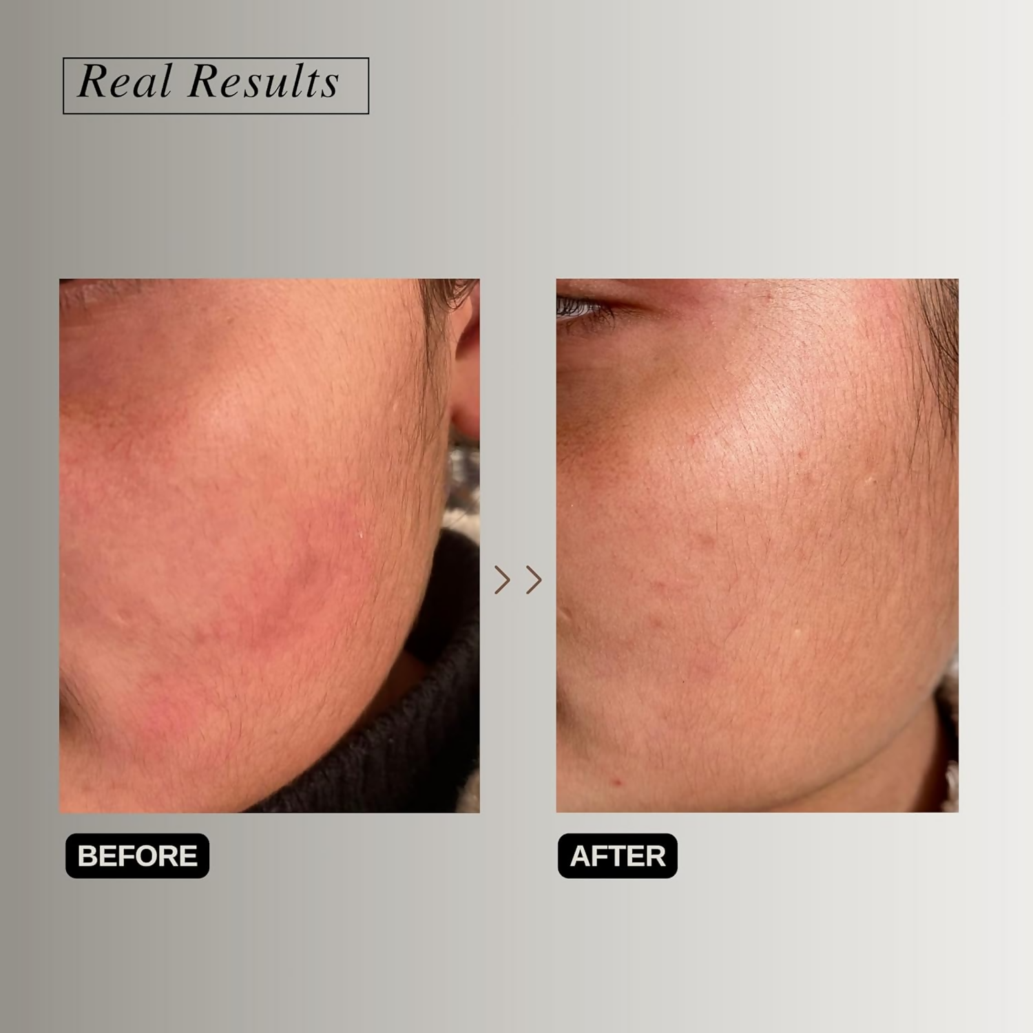 The Formularx Peptide Ceramide Moisturizer - Barrier Plus